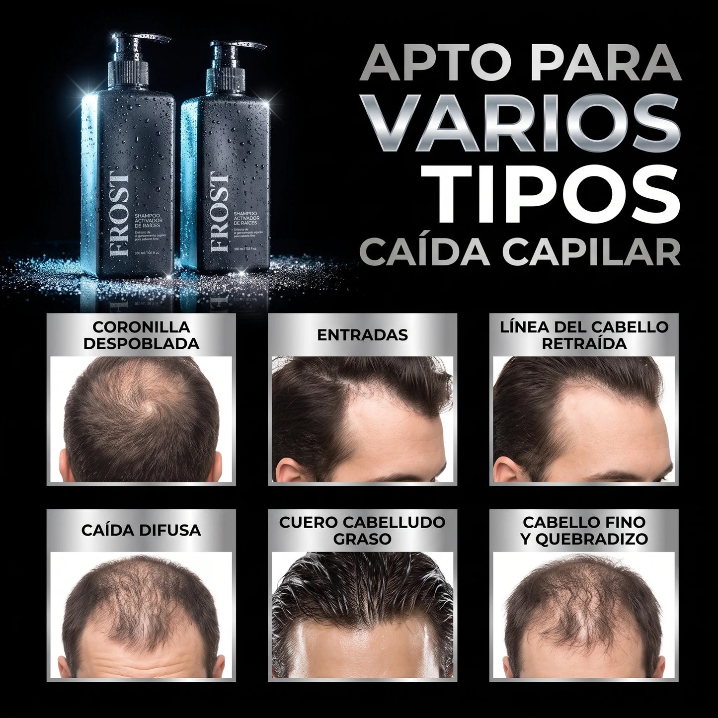 Frost™ Shampoo Anticaída y Crecimiento