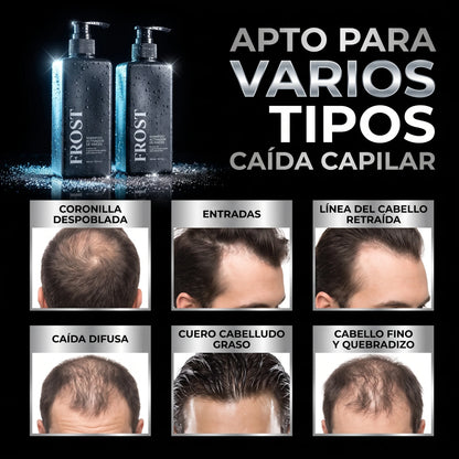 Frost™ Shampoo Anticaída y Crecimiento