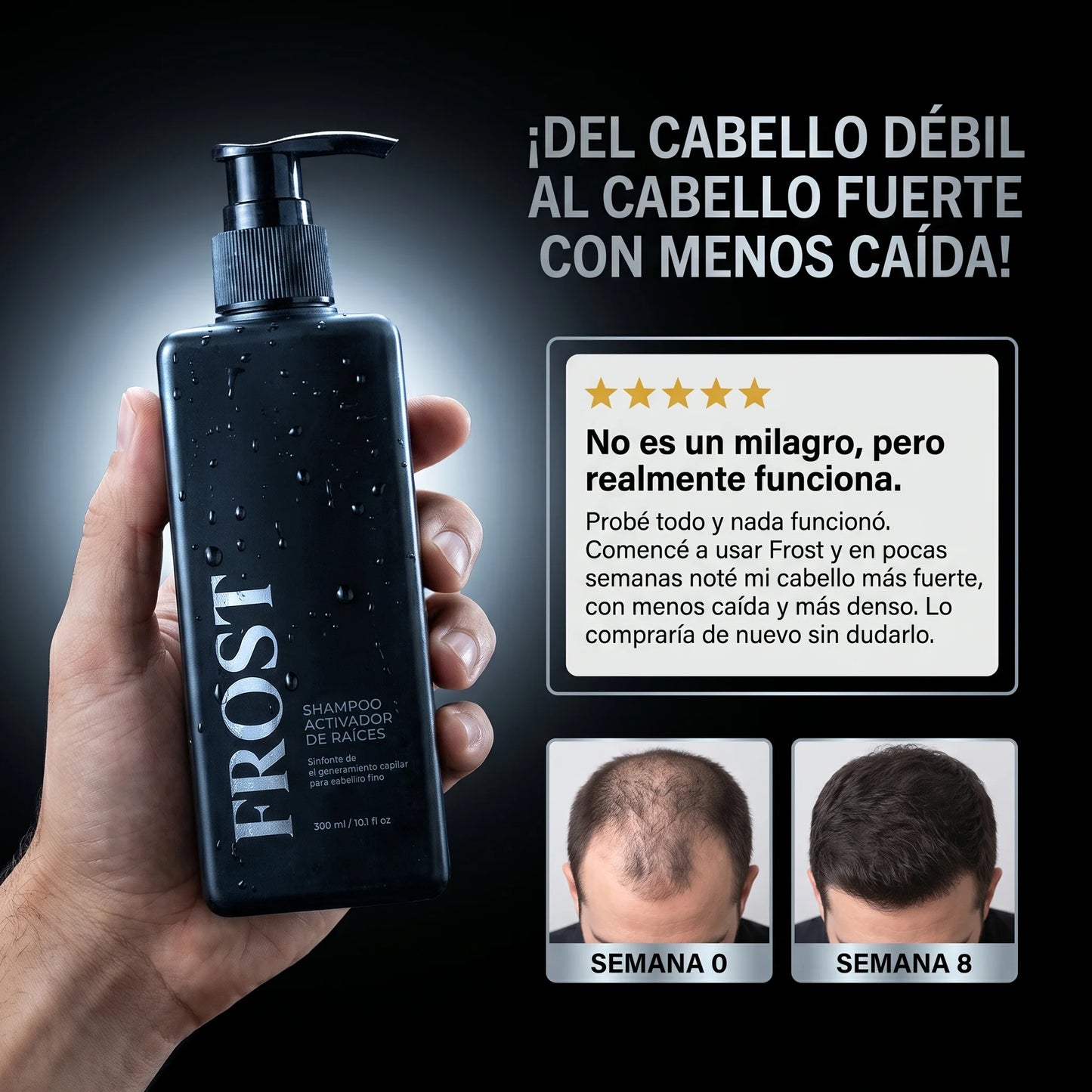 Frost™ Shampoo Anticaída y Crecimiento