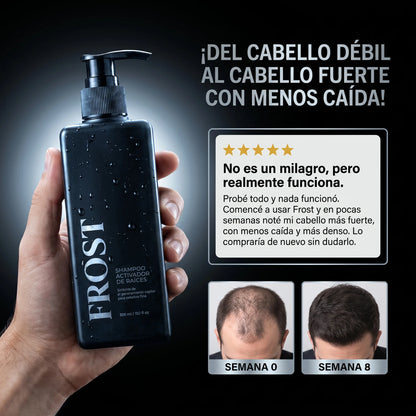 Frost™ Shampoo Anticaída y Crecimiento